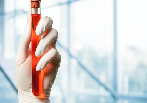 現(xiàn)在美國試管嬰兒的費用是多少