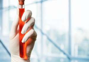 現(xiàn)在美國(guó)試管嬰兒的費(fèi)用是多少