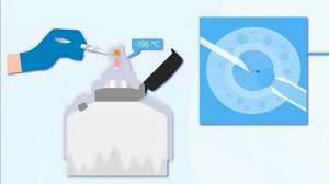 試管嬰兒的概率高嗎