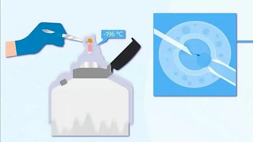 試管嬰兒的概率高嗎