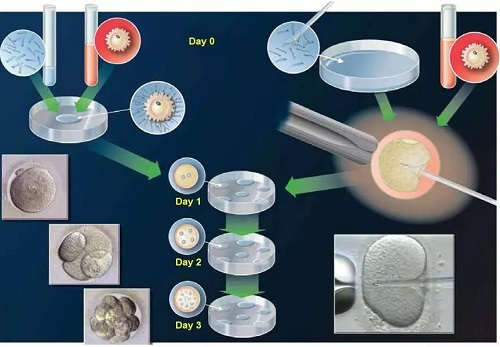做試管嬰兒就能生