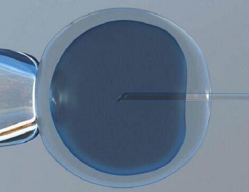 美國(guó)和泰國(guó)試管嬰兒哪個(gè)好