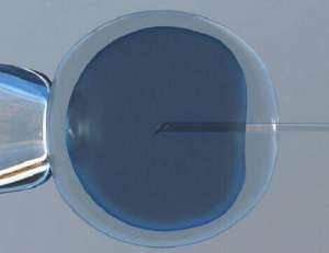 美國(guó)和泰國(guó)試管嬰兒哪個(gè)好