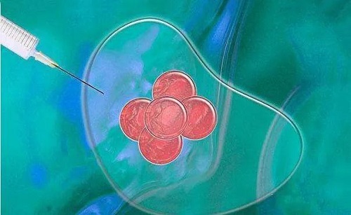 泰國試管嬰兒存在失敗風(fēng)險(xiǎn)嗎