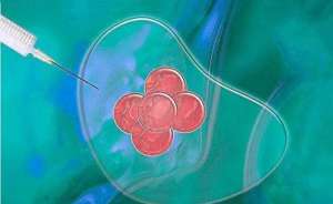 泰國試管嬰兒存在失敗風(fēng)險嗎