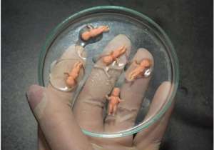 泰國試管嬰兒存在風(fēng)險嗎