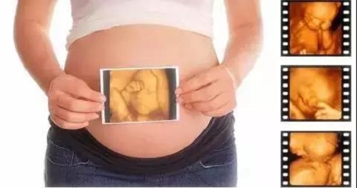 美國試管嬰兒優(yōu)勢是什么