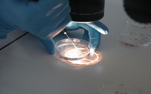 去俄羅斯試管嬰兒做需要多少錢(qián)