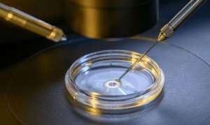 俄羅斯試管嬰兒技術(shù)怎么樣