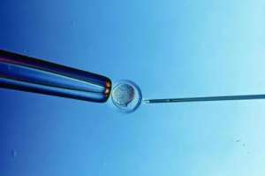 俄羅斯做試管總花費(fèi)