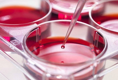 泰國試管嬰兒中介費用包括哪些方面