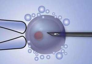 選擇俄羅斯試管嬰兒方向中介機(jī)構(gòu)的方法