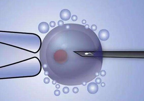 選擇俄羅斯試管嬰兒方向中介機(jī)構(gòu)的方法