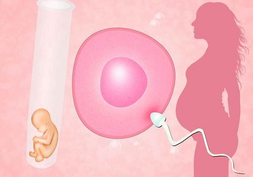 做俄羅斯試管嬰兒有什么優(yōu)勢