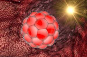 去俄羅斯做試管嬰兒怎么選中介